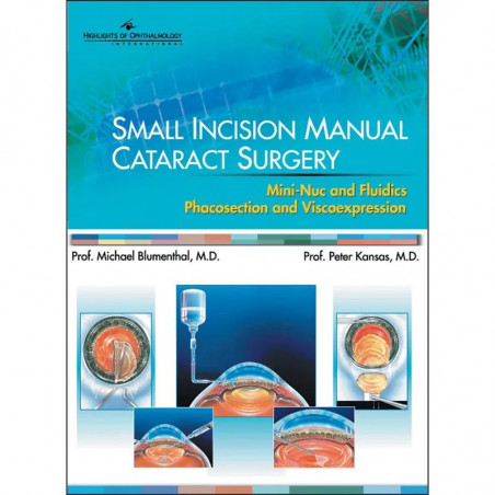 Small Incision Manual Cataract Surgery book by Michael Blumenthal, Peter Kansas