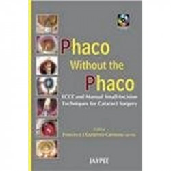 Phaco without the Phaco with 2 Interactive CD-ROMs book by Carmona