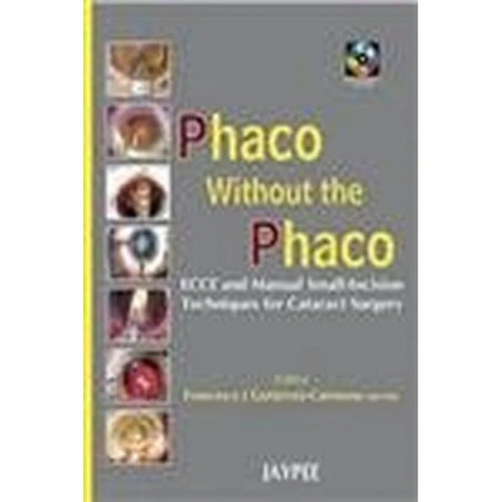 Phaco without the Phaco with 2 Interactive CD-ROMs book by Carmona