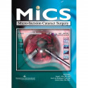 MICS Micro-Incision Cataract Surgery(with CD-ROM) book by Alio