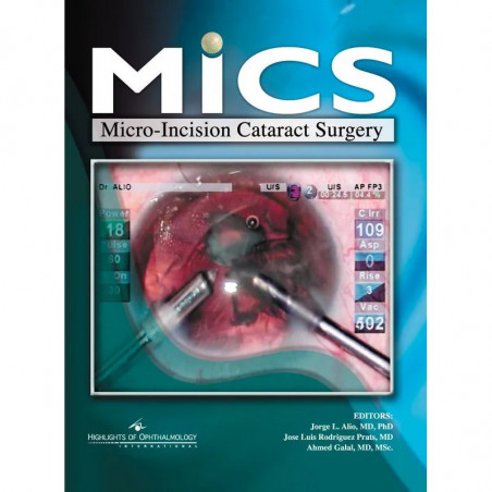 MICS Micro-Incision Cataract Surgery(with CD-ROM) book by Alio