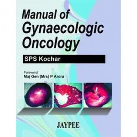 Manual of Gynaecologic Oncology book by S.P.S. Kochar