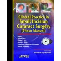 Clinical Practice in Small Incision Catract Surgery (Phaco Manual) (with 2 CD Roms) book by Ashok Garg
