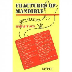 Fractures of Mandible book by Sen