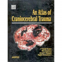 An Atlas of Craniocerebral Trauma book by Kumar