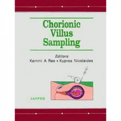 Chorionic Villus Sampling book by Kamini A. Rao, Kypros Nicolaides