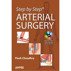 Step by Step Arterial Surgery book by Choudhry