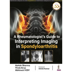 A RHEUMATOLOGIST’S GUIDE TO INTERPRETING IMAGING IN SPONDYLOARTHRITIS book by Ashish Sharma, Vivek Arya