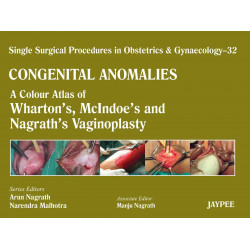 CONGENITAL ANOMALIES-32 A C.A.OF WHARTON'S,MCLNDOE'S AND NAGRATH'S VAGINOPLASTY(SSPO&G) book by Nagrath