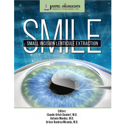 SMILE: Small Incision Lenticule Extraction book by Claudio Orlich Dunddorf, Antonio Mendez