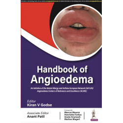 Handbook of Angioedema book by Kiran V Godse, Anant Patil