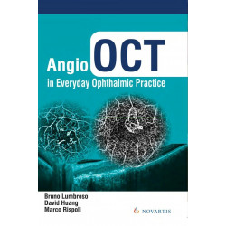 Angio OCT in Everyday Ophthalmic Practice book by Bruno Lumbroso, David Huang