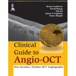 CLINICAL GUIDE TO ANGIO-OCT: NON INVASIVE,DYELESS OCT ANGIOGRAPHY book by Lumbroso Bruno