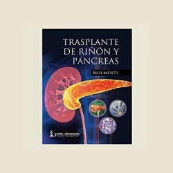 TRASPLANTE DE RINONY PANCREAS book
