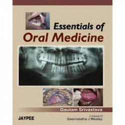 Essentials of Oral Medicine book by Srivastava
