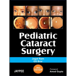 Pediatric Cataract Surgery (with DVD-ROM) (POD) book by Jagat Ram