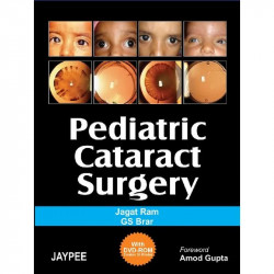 Pediatric Cataract Surgery (with DVD-ROM) (POD) book by Jagat Ram - Back Cover