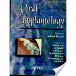 ORAL IMPLANTOLOGY book