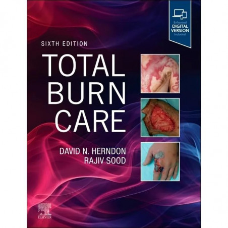 Total Burn Care book by David Herndon, Rajiv Sood
