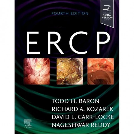 ERCP book by Todd H. Baron, David L Carr-Locke