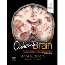 OSBORNS BRAIN IMAGING PATHOLOGY AND ANATOMY WITH ACCESS CODE 3ED (HB 2024) book by Anne G. Osborn, Luke L. Linscott