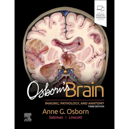 OSBORNS BRAIN IMAGING PATHOLOGY AND ANATOMY WITH ACCESS CODE 3ED (HB 2024) book by Anne G. Osborn, Luke L. Linscott