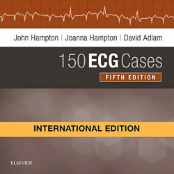 150 ECG Cases, International Edition, 5e book by Hampton