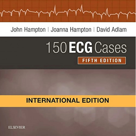150 ECG Cases, International Edition, 5e book by Hampton