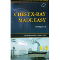 Chest X0Ray Made Easy, 5e book by Jonathan Corne