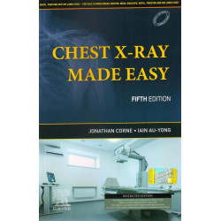Chest X0Ray Made Easy, 5e book by Jonathan Corne