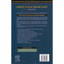 Chest X0Ray Made Easy, 5e book by Jonathan Corne - Additional Image 4