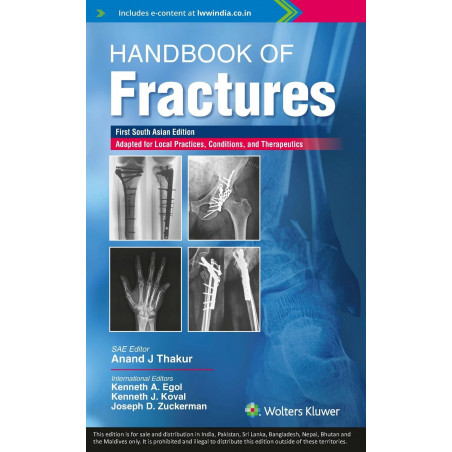 Handbook of fractures, 1st South Asian ed book by Anand J. Thakur, Kenneth A. Egol