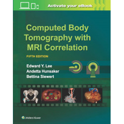 Computed Body Tomography with MRI Correlation, 5ed book by Edward Y. Lee, Andetta Hunsaker