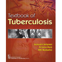 Textbook of Tuberculosis book by Sunnam Satyasri, N. Usha Rani