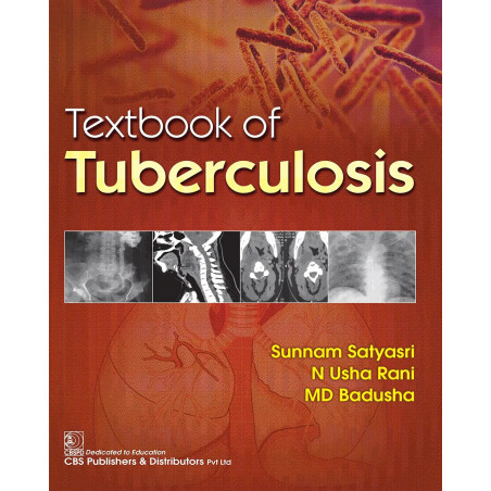 Textbook of Tuberculosis book by Sunnam Satyasri, N. Usha Rani