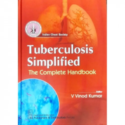 Tuberculosis Simplified The Complete Handbook (Hb 2024) book by KUMAR V.V.