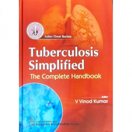 Tuberculosis Simplified The Complete Handbook (Hb 2024) book by KUMAR V.V.