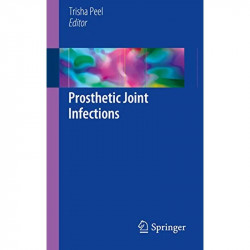 Prosthetic Joint Infections (PB 2018) book by Peel T