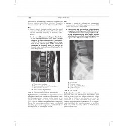 MCQs in Pain Medicine, 2/e | Over 2100 MCQs (PB 2026) book by Chinmoy Roy, Debjyoti Dutta - Additional Image 5