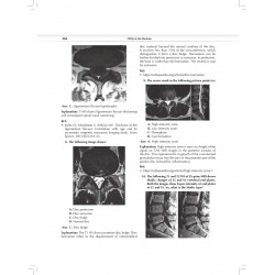 MCQs in Pain Medicine, 2/e | Over 2100 MCQs (PB 2026) book by Chinmoy Roy, Debjyoti Dutta - Additional Image 7