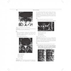 MCQs in Pain Medicine, 2/e | Over 2100 MCQs (PB 2026) book by Chinmoy Roy, Debjyoti Dutta - Additional Image 8