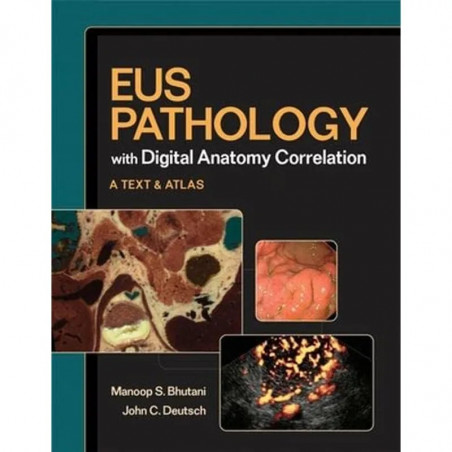 Eus Pathology With Digital Anatomy Correlation Textbook And Atlas (Hb 2010) book by Manoop S. Bhutani, John Deutsch