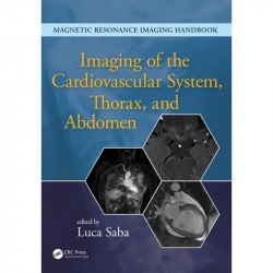IMAGING OF THE CARDIOVASCULAR SYSTEM THORAX AND ABDOMEN (HB 2017): Volume 2 (Magnetic Resonance Imaging Handbook) book by Lu…