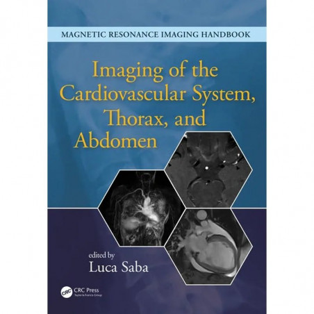 IMAGING OF THE CARDIOVASCULAR SYSTEM THORAX AND ABDOMEN (HB 2017): Volume 2 (Magnetic Resonance Imaging Handbook) book by Lu…