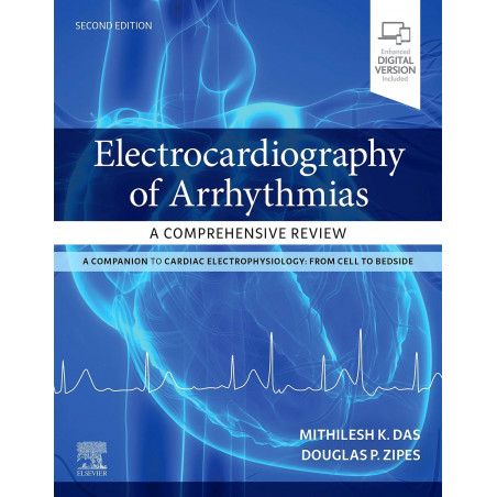 Electrocardiography Of Arrhythmias A Comprehensive Review 2Ed (Pb 2022) book by Mithilesh Kumar Das, Douglas P. Zipes