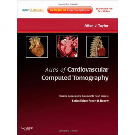 Atlas of Cardiovascular Computed Tomography: Expert Consult - Online and Print: Imaging Companion to Braunwald's Heart Disea…