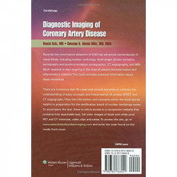 Diagnostic Imaging Of Coronary Artery Disease Aziz, Kusai And Abela, George S. book by Kusai S. Aziz, George S. Abela