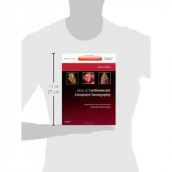 Atlas of Cardiovascular Computed Tomography: Expert Consult - Online and Print: Imaging Companion to Braunwald's Heart Disea… -