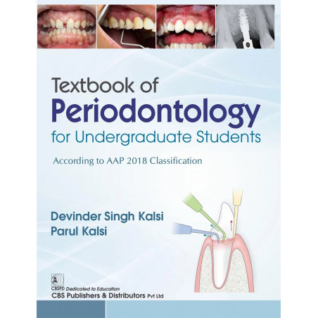 Textbook Of Periodontology For Undergraduate Students (Pb 2025) book by Devinder Singh Kalsi, Parul Kalsi