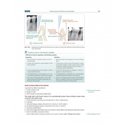 Textbook Of Periodontology For Undergraduate Students (Pb 2025) book by Devinder Singh Kalsi, Parul Kalsi - Additional Image 5